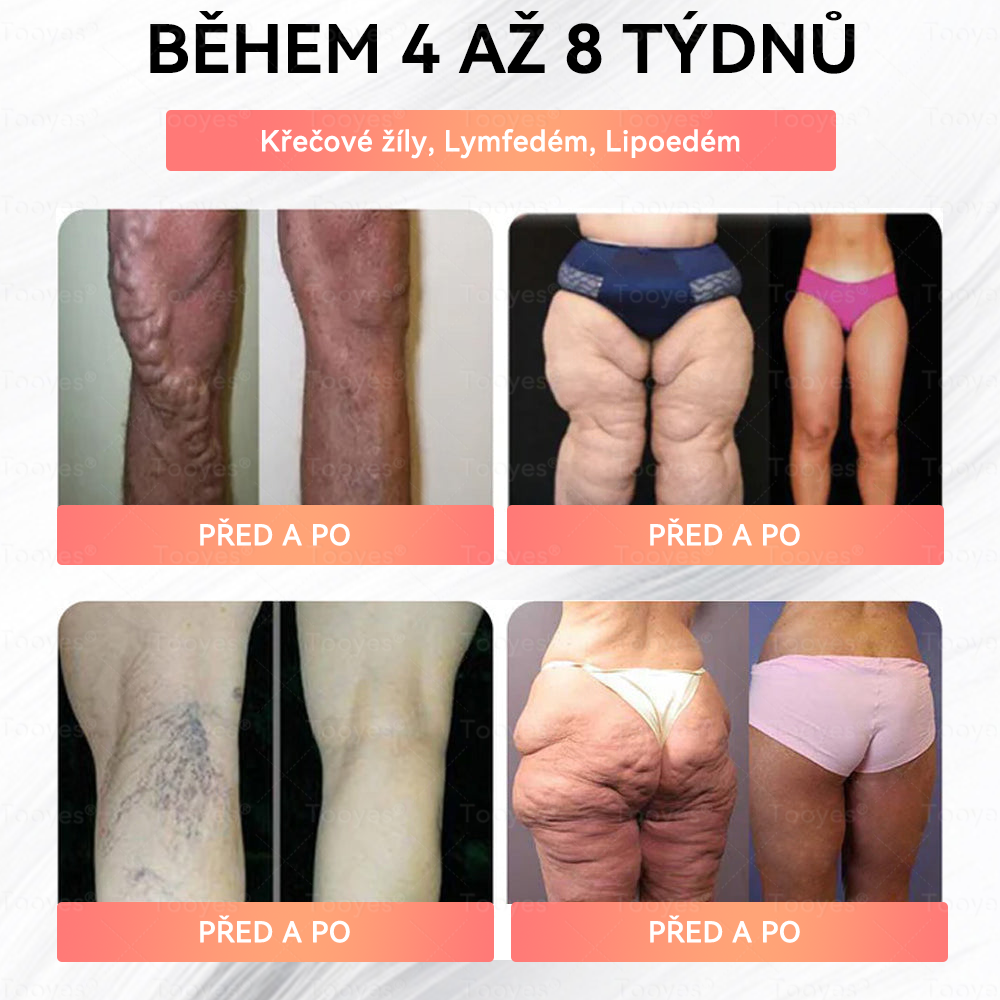 💟 Tooyes® GLP-1 Vysoce koncentrované tekuté perly – s obsahem NAD+, Moringa, HCA (Hubnutí, Anti-aging, Podpora střev a imunitního systému, Rovnováha hladiny cukru v krvi, Zdraví srdce a mozku) ⚡