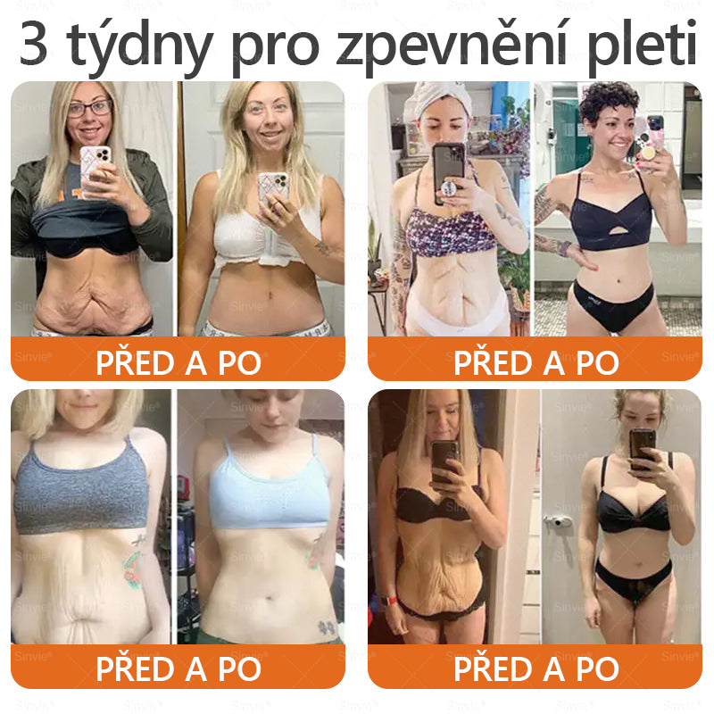✨ ✨ Doporučení dermatologa 🐝 Sinvie® Krém na obnovu pleti s včelím jedem 🔥 Český vývoj, výroba a dodávka v České republice