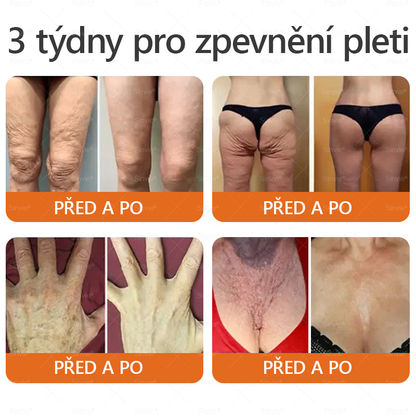 ✨ ✨ Doporučení dermatologa 🐝 Sinvie® Krém na obnovu pleti s včelím jedem 🔥 Český vývoj, výroba a dodávka v České republice