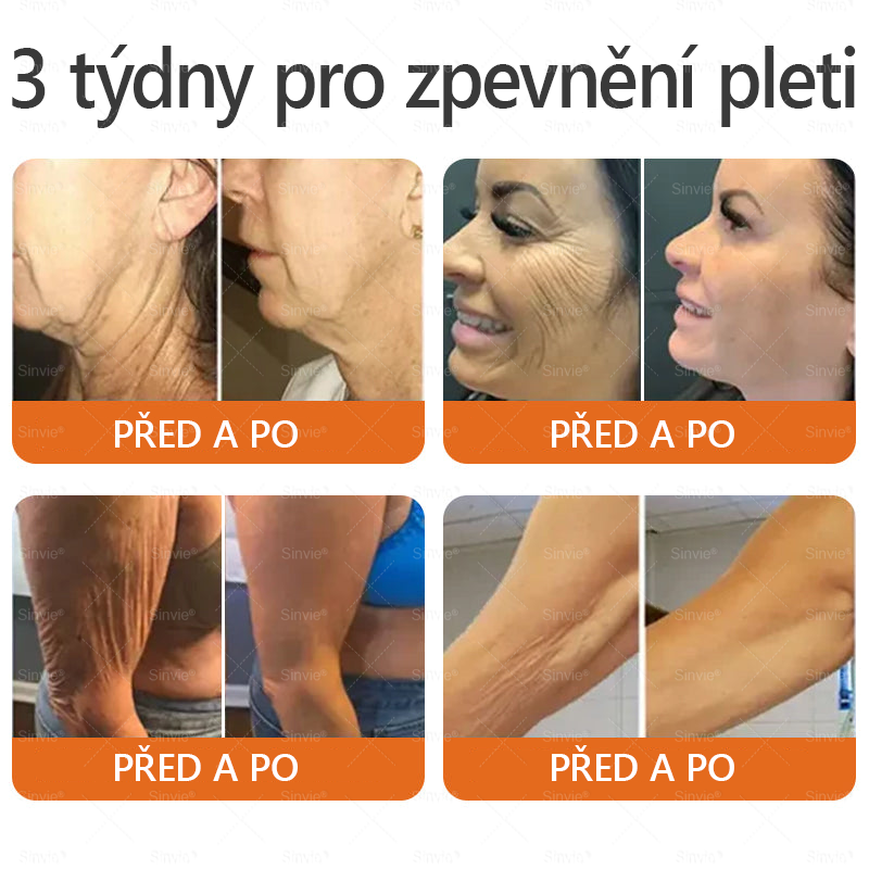 ✨ ✨ Doporučení dermatologa 🐝 Sinvie® Krém na obnovu pleti s včelím jedem 🔥 Český vývoj, výroba a dodávka v České republice