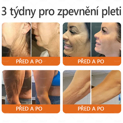 ✨ ✨ Doporučení dermatologa 🐝 Sinvie® Krém na obnovu pleti s včelím jedem 🔥 Český vývoj, výroba a dodávka v České republice