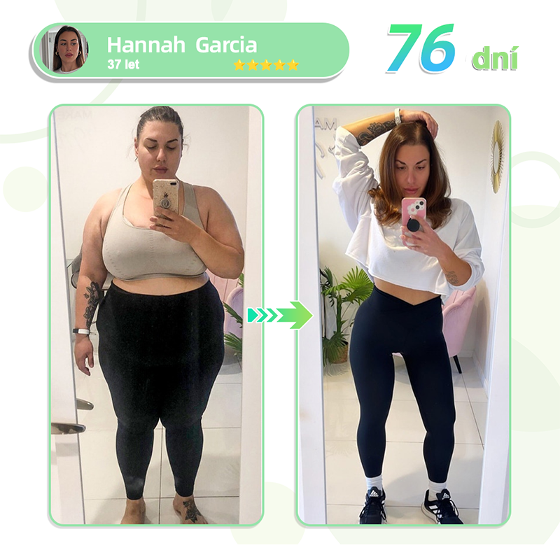 🔥🔥  [Výsledky již po 7 dnech] 🌲Voilaist® nano náplast s mikrojehlami SMGT-GLP-1 (Bez bolesti, dlouhodobý účinek, pomáhá při cukrovce, obezitě a kardiovaskulárních onemocněních)