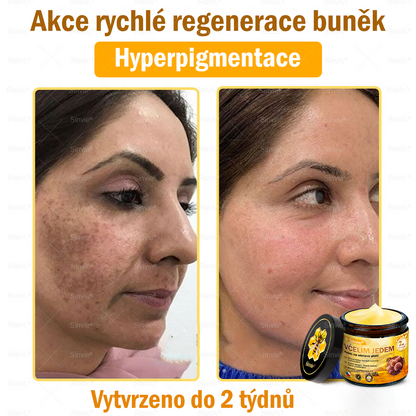 ✨ ✨ Doporučení dermatologa 🐝 Sinvie® Krém na obnovu pleti s včelím jedem 🔥 Český vývoj, výroba a dodávka v České republice