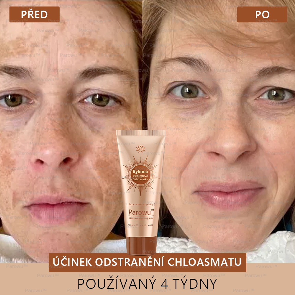🎁 Parowu™ Bělící a Odstraňující Skvrny Maska -🍀 🎁